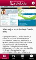 SEC-Arritmias