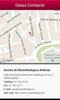 SEC-Arritmias