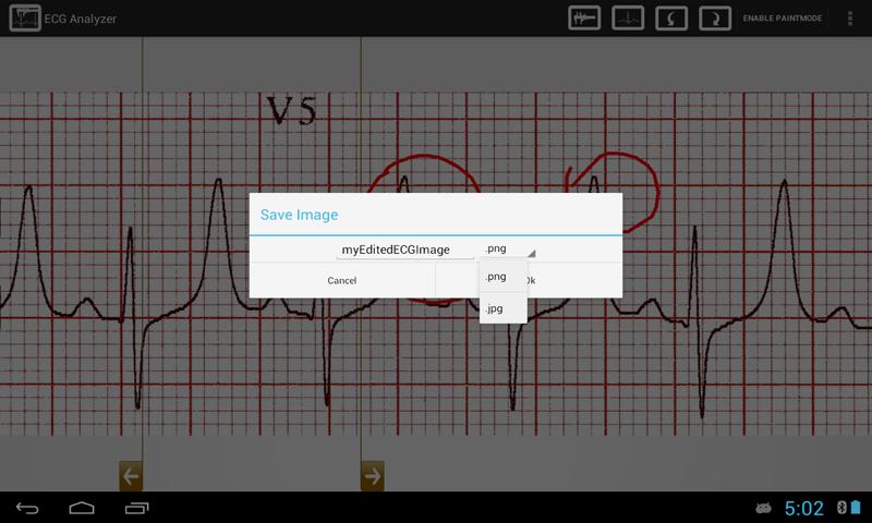 ECG Analyzer