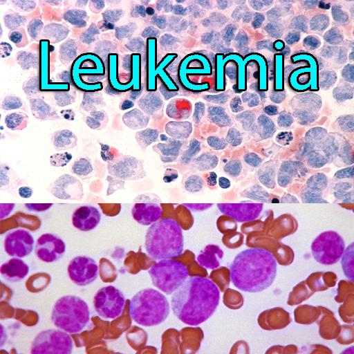 Leukemia