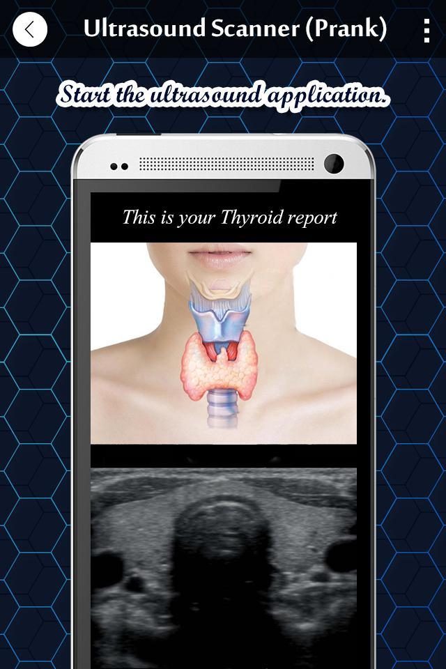 Ultrasound X-ray Scanner Prank