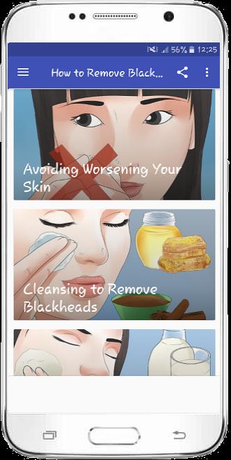 How to Remove Blackheads