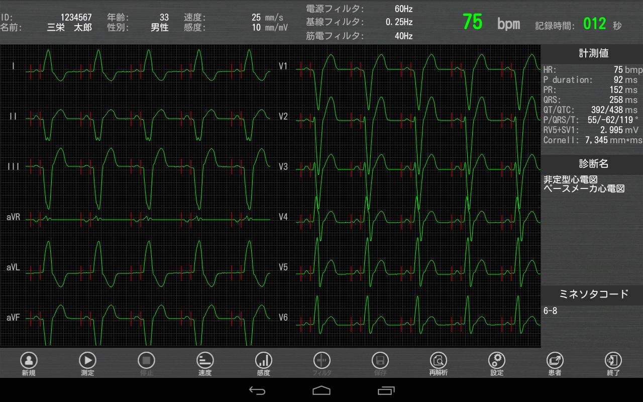 Tablet ECG