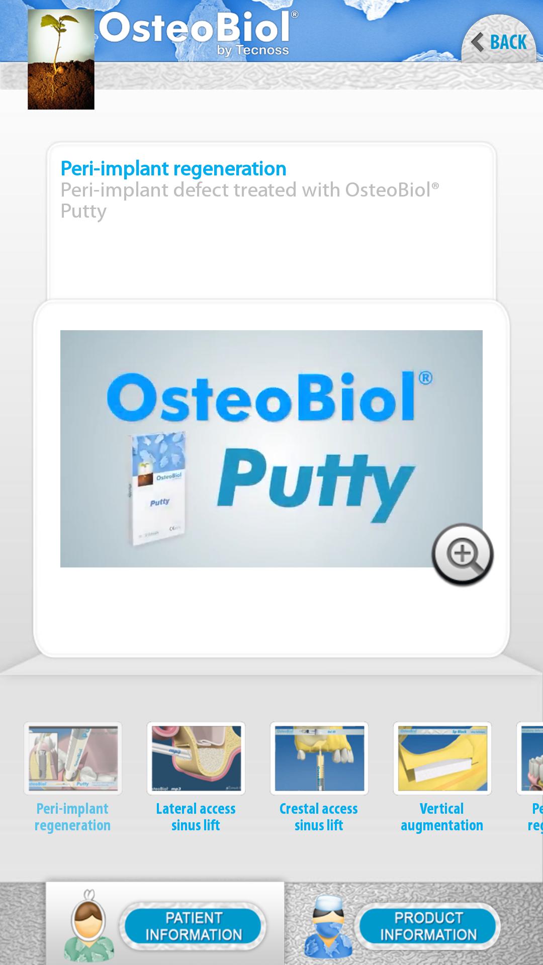 OsteoBiol by Tecnoss Phone