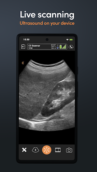 Clarius Ultrasound
