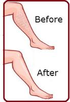 Malayalam Beauty tips