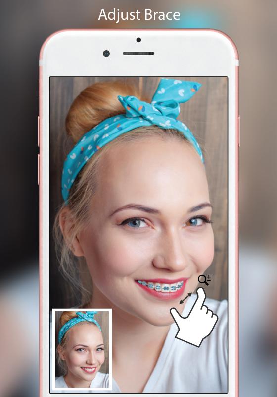 Braces Selfie Beauty Camera