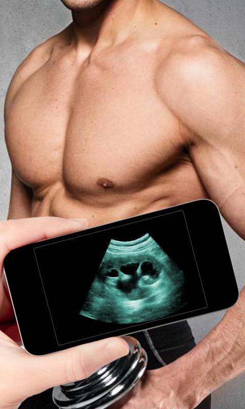 Ultra Sound Simulator : Prank