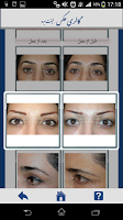 Eye Plastic Surgeries
